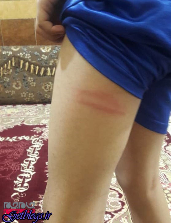 تصویر + جزئیات تنبیه بدنی دانش‌آموزان یکی از مدارس بندرماهشهر به وسیله ناظم